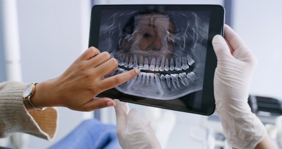 Tablet showing a patient's dental X-ray