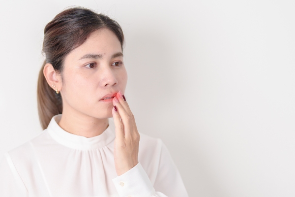 Woman in pain from an oral lesion